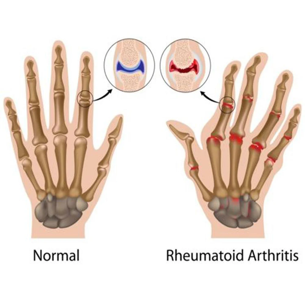 1 Pair Magnetic Therapy Fingerless Gloves Anti Arthritis Pain Relief Compression Therapy Gloves Heal Joints