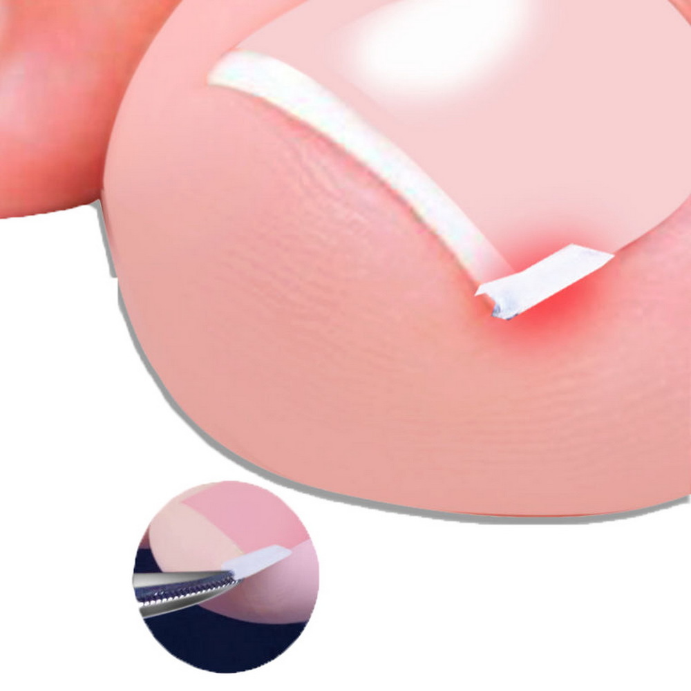 10pcs Ingrown Toenail Correction Tool Ingrown Toe Nail Treatment Elastic Patch Sticker Straightening Clip Brace 10pcs Ingrown Toenail Correction Tool Ingrown Toe Nail Treatment Elastic Patch Sticker Straightening Clip Brace
