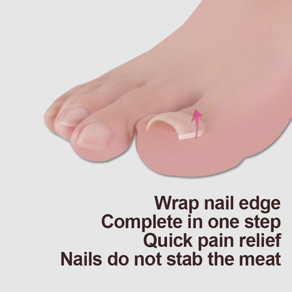10pcs Ingrown Toenail Correction Tool Ingrown Toe Nail Treatment Elastic Patch Sticker Straightening Clip Brace 10pcs Ingrown Toenail Correction Tool Ingrown Toe Nail Treatment Elastic Patch Sticker Straightening Clip Brace