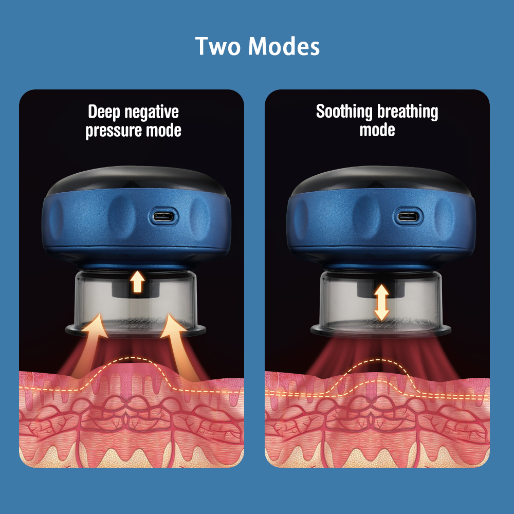 12 Level Electric Cupping Massage Device Wireless Gua Sha Vacuum Suction Cups Massage Negative Pressure Body Scraping 12 Level Electric Cupping Massage Device Wireless Gua Sha Vacuum Suction Cups Massage Negative Pressure Body Scraping
