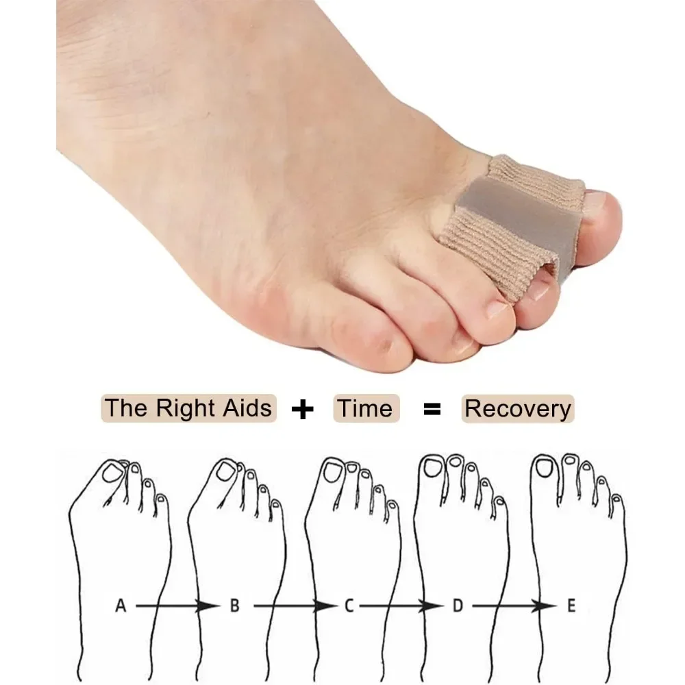 1/2Pc Two Toe Separator Hallux Valgus Bunion Corrector Orthotics Feet Bone Thumb Adjuster Correction Pedicure Feet