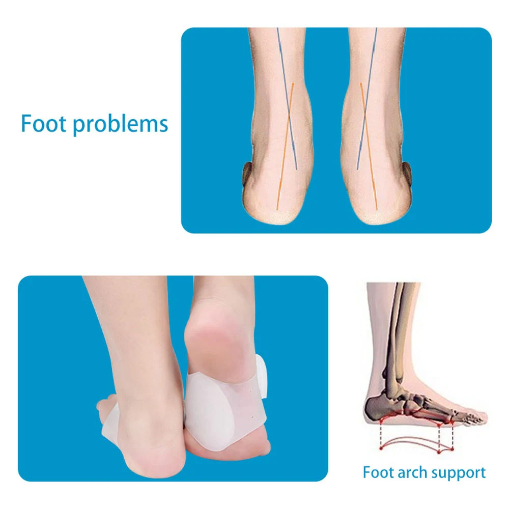 1Pair Arch Support Brace – Non-Slip Sole Foot Arch Support Plantar Fasciitis Heel Pain Aid Feet Care Absorb Shock 1Pair Arch Support Brace – Non-Slip Sole Foot Arch Support Plantar Fasciitis Heel Pain Aid Feet Care Absorb Shock