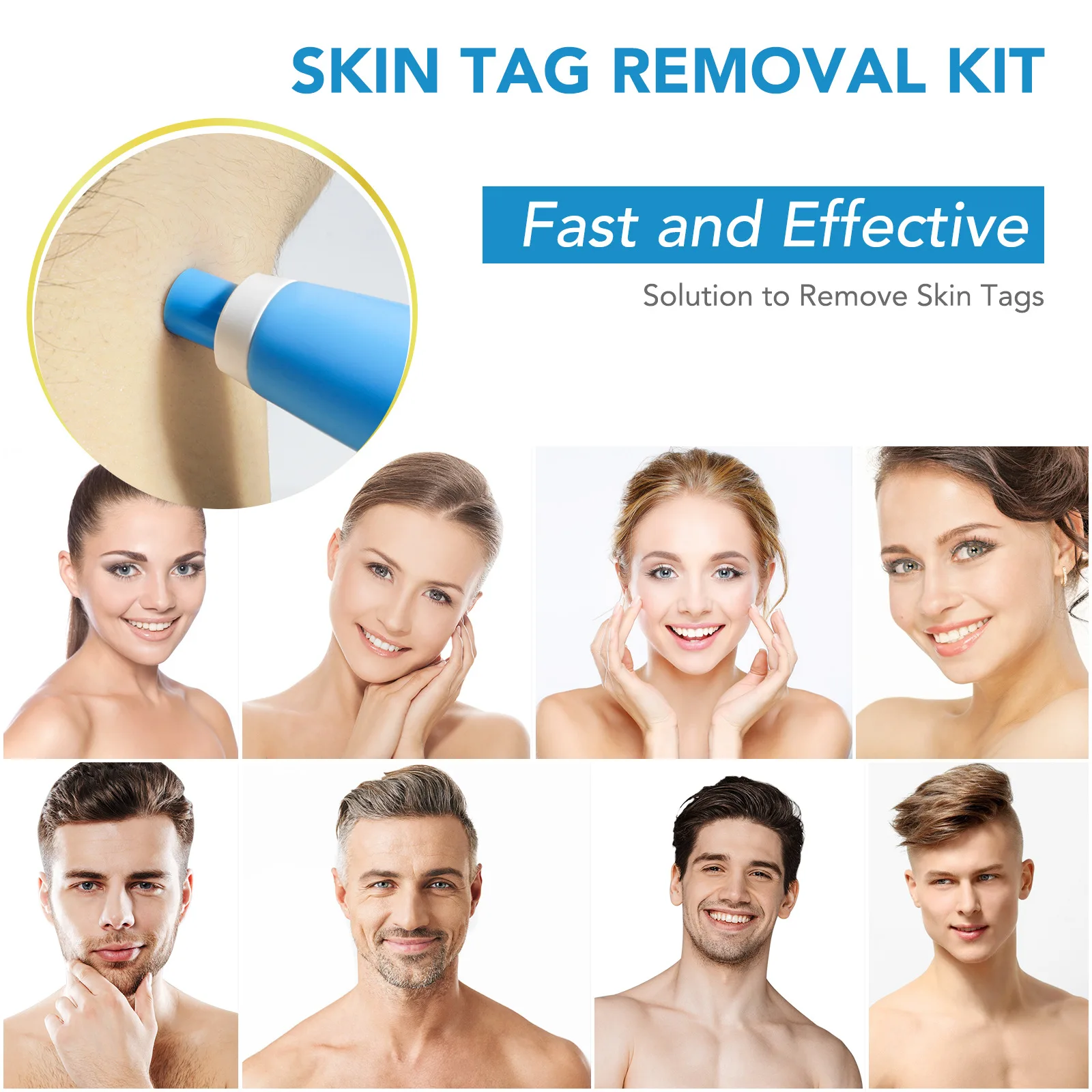 2 IN 1 Auto Skin Tag Remover Kit Micro Skin Tag Removal Device Adult Mole Stain Wart Remover Face Care Beauty Tools 2 IN 1 Auto Skin Tag Remover Kit Micro Skin Tag Removal Device Adult Mole Stain Wart Remover Face Care Beauty Tools