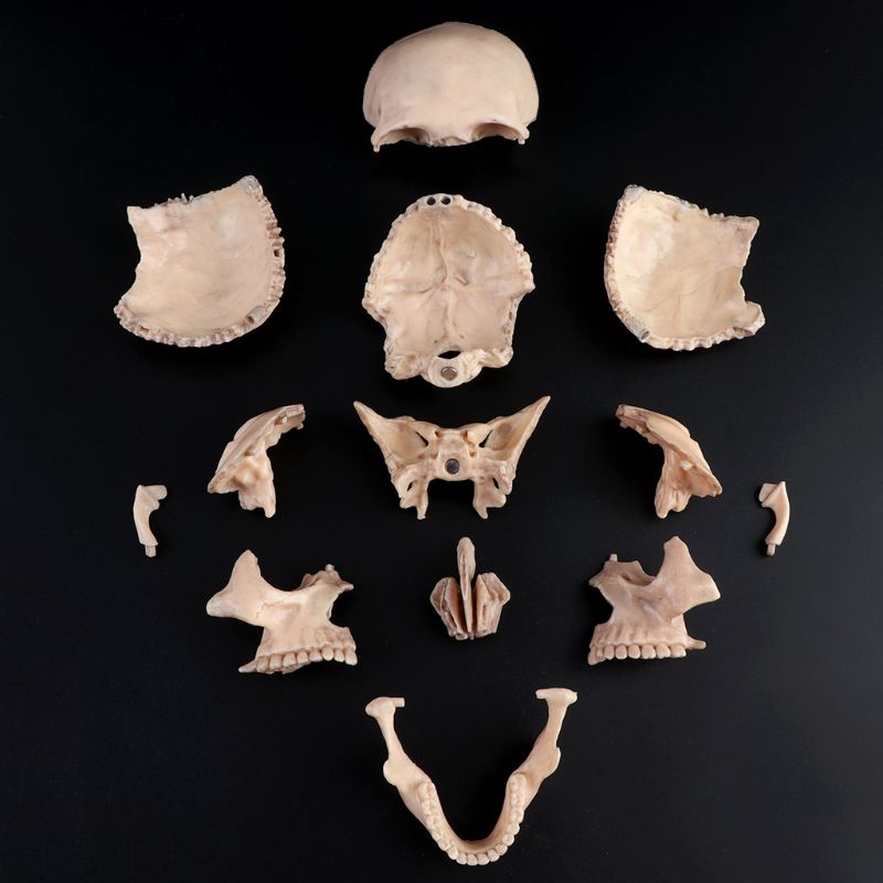 4D Detachable Parts Anatomy Skull Model (15 pcs) 4D Detachable Parts Anatomy Skull Model (15 pcs)