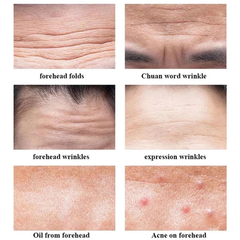 6pcs Anti Wrinkle Forehead Line Removal Gel Patch Firming Mask Frown Lines Face Skin Care Treatment Stickers Anti-aging