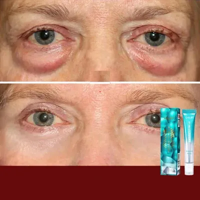 7 Days Anti-Wrinkle Magic Eye Cream Remove Eye Bags Dark Circles Puffiness Lift Firm Smooth Skin Care Moisturizing