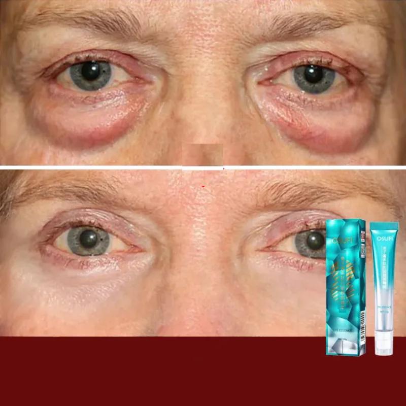 7 Days Anti-Wrinkle Magic Eye Cream Remove Eye Bags Dark Circles Puffiness Lift Firm Smooth Skin Care Moisturizing
