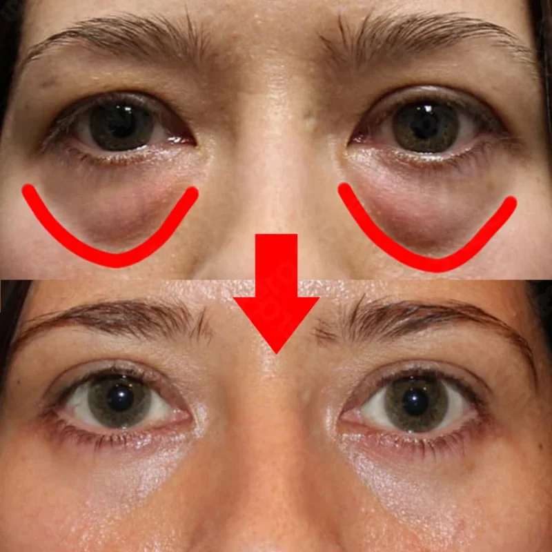 7 Days Anti-Wrinkle Magic Eye Cream Remove Eye Bags Dark Circles Puffiness Lift Firm Smooth Skin Care Moisturizing