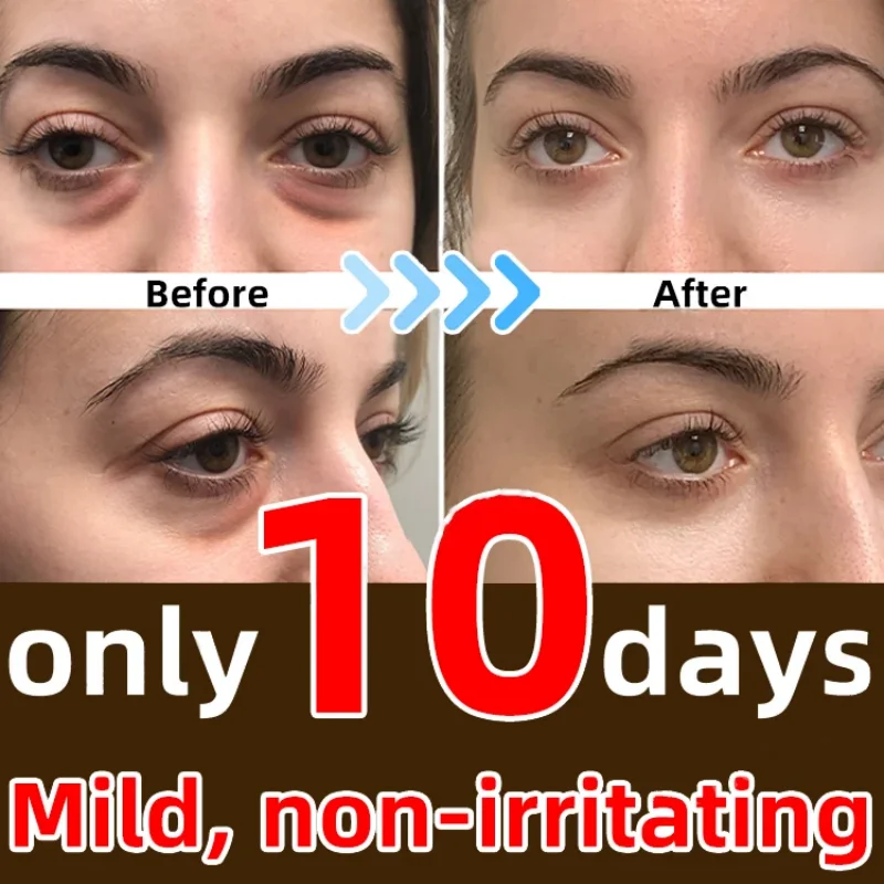 7 Days Anti-Wrinkle Magic Eye Cream Remove Eye Bags Dark Circles Puffiness Lift Firm Smooth Skin Care Moisturizing