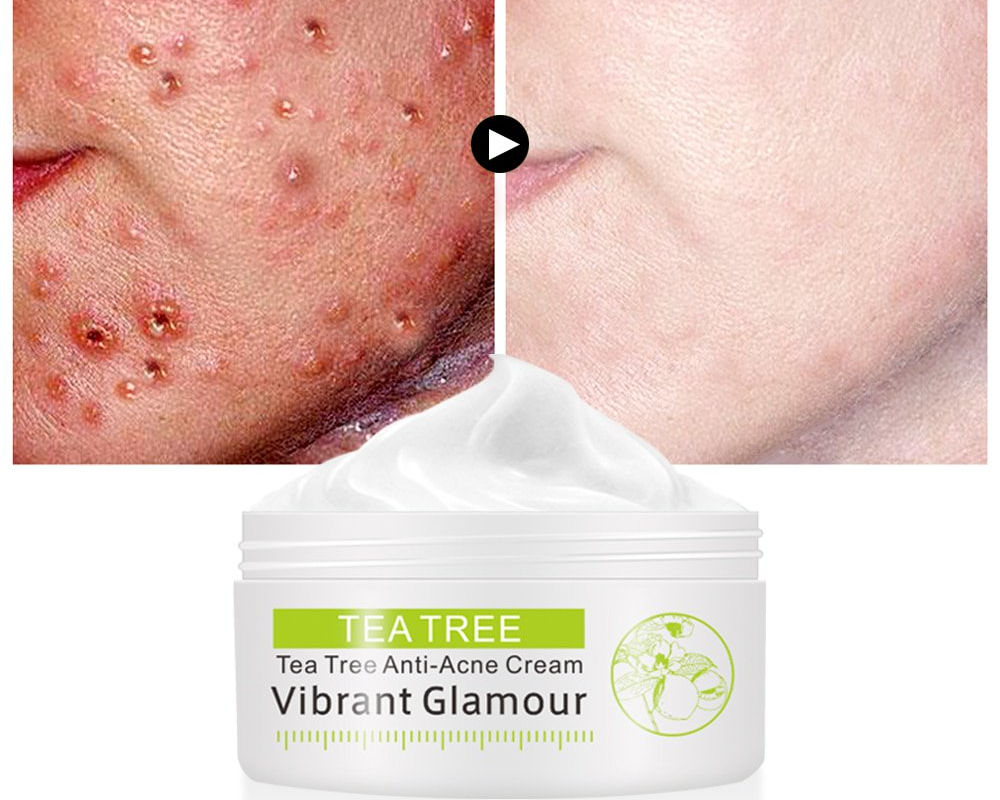 Acne Cream Facial Skin Care Acne Cream Facial Skin Care