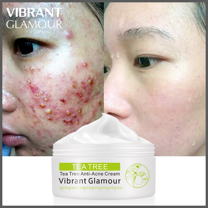 Acne Cream Facial Skin Care Acne Cream Facial Skin Care