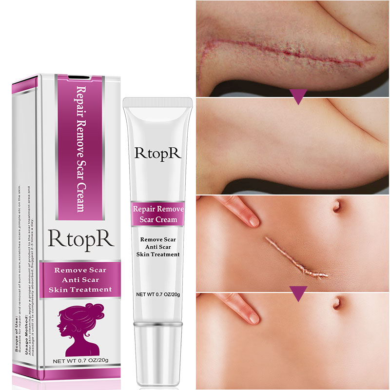 Acne Scar Cream Skin Repair