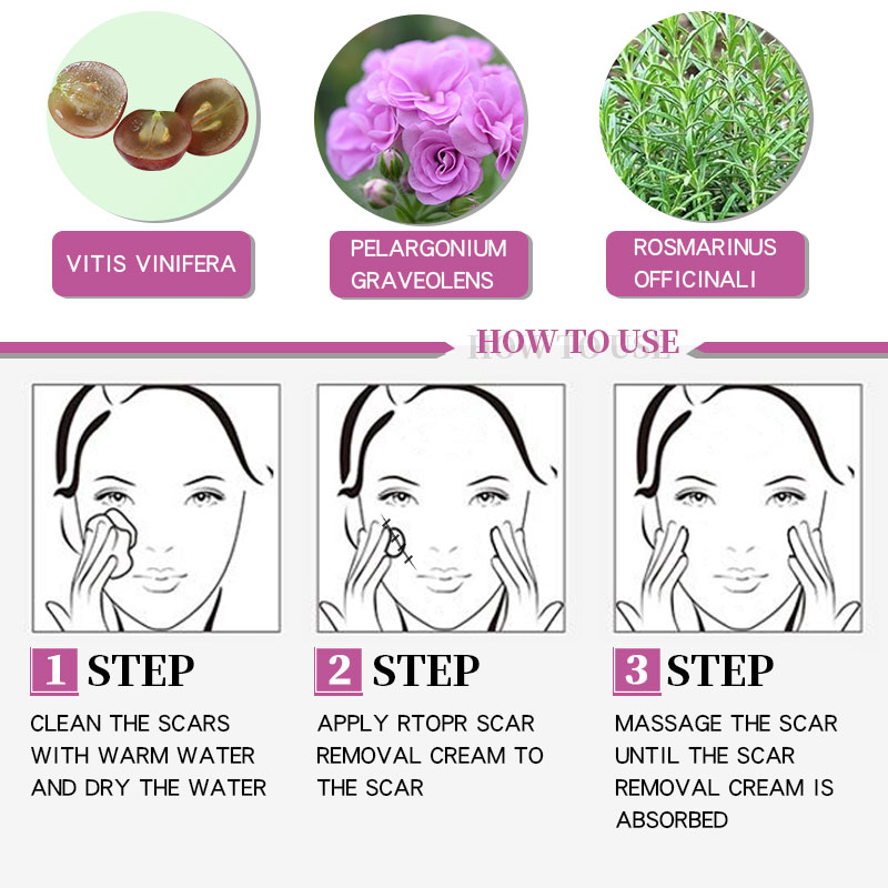 Acne Scar Cream Skin Repair