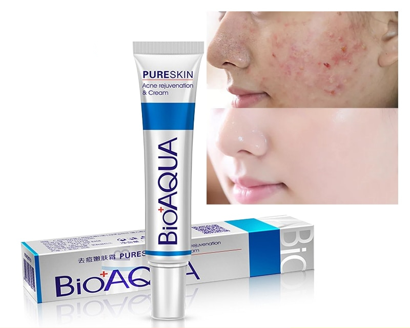 Acne Treatment BioAqua Skin Healer Acne Treatment BioAqua Skin Healer