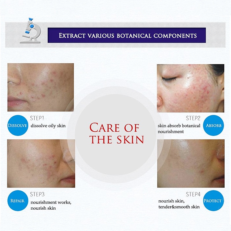 Acne Treatment BioAqua Skin Healer Acne Treatment BioAqua Skin Healer