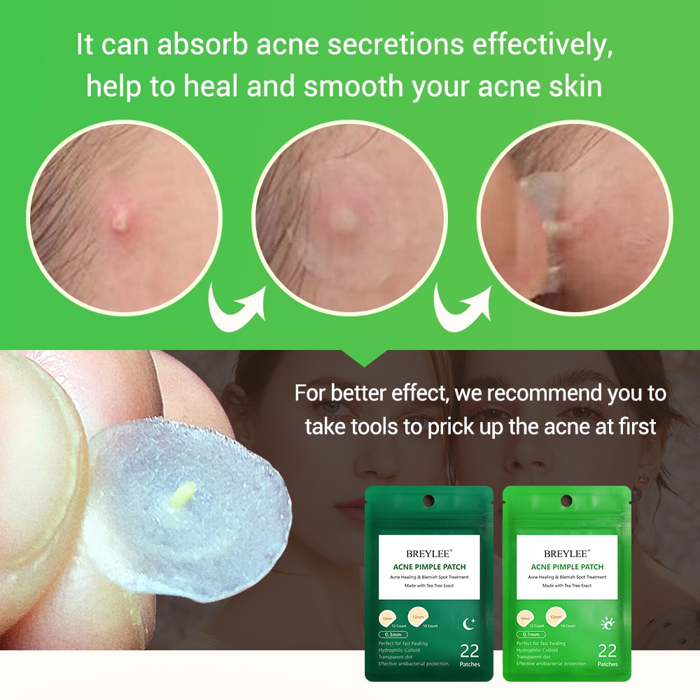 Acne Treatments Pimple Patch