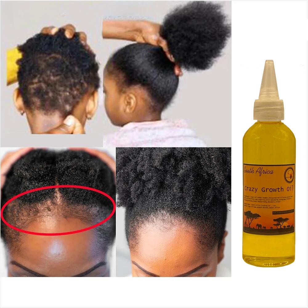 Africa Crazy Hair Growth Oil Chebe Powder Prevent and Slow Hair Loss Stop Breakage for Hair Growth