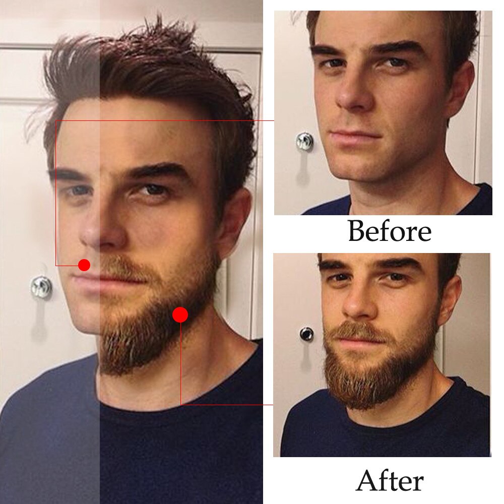 All Natural Beard Growth Oil All Natural Beard Growth Oil