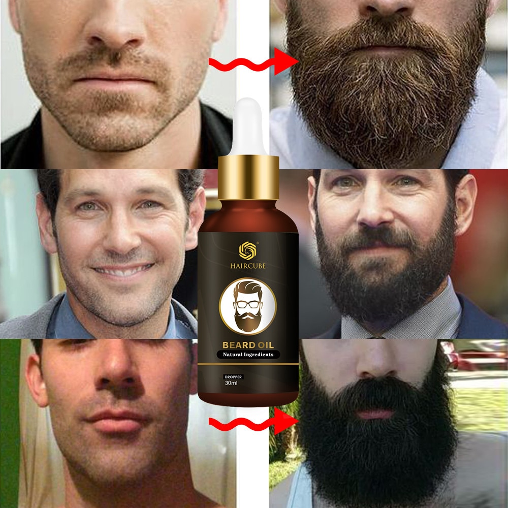 All Natural Beard Growth Oil All Natural Beard Growth Oil