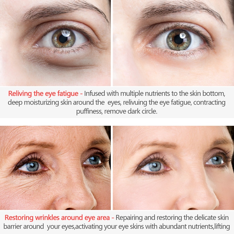 Anti Aging Cream Wrinkle Remover Anti Aging Cream Wrinkle Remover