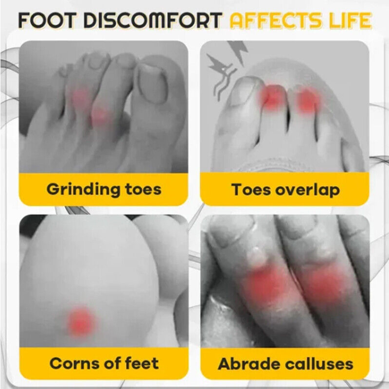 Anti Friction Silicone Toe Caps (10 Pcs) Anti Friction Silicone Toe Caps (10 Pcs)
