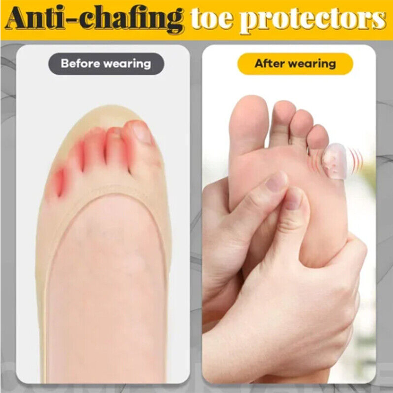 Anti Friction Silicone Toe Caps (10 Pcs) Anti Friction Silicone Toe Caps (10 Pcs)