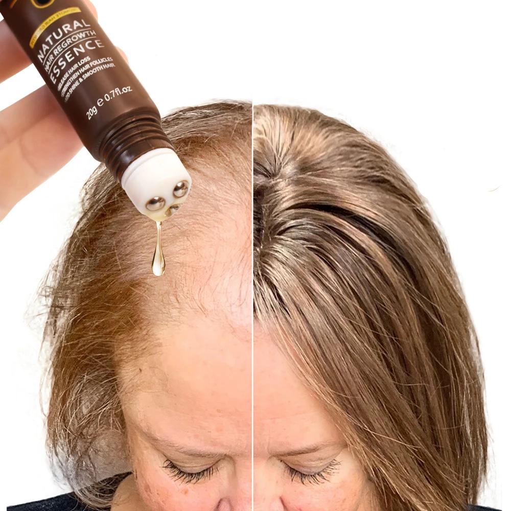 Anti Hair Loss Hair Growth Products Men Women Bald Remedy Roller Scalp Massage Treatment Ginger Fast Grow Hair Serum Anti Hair Loss Hair Growth Products Men Women Bald Remedy Roller Scalp Massage Treatment Ginger Fast Grow Hair Serum