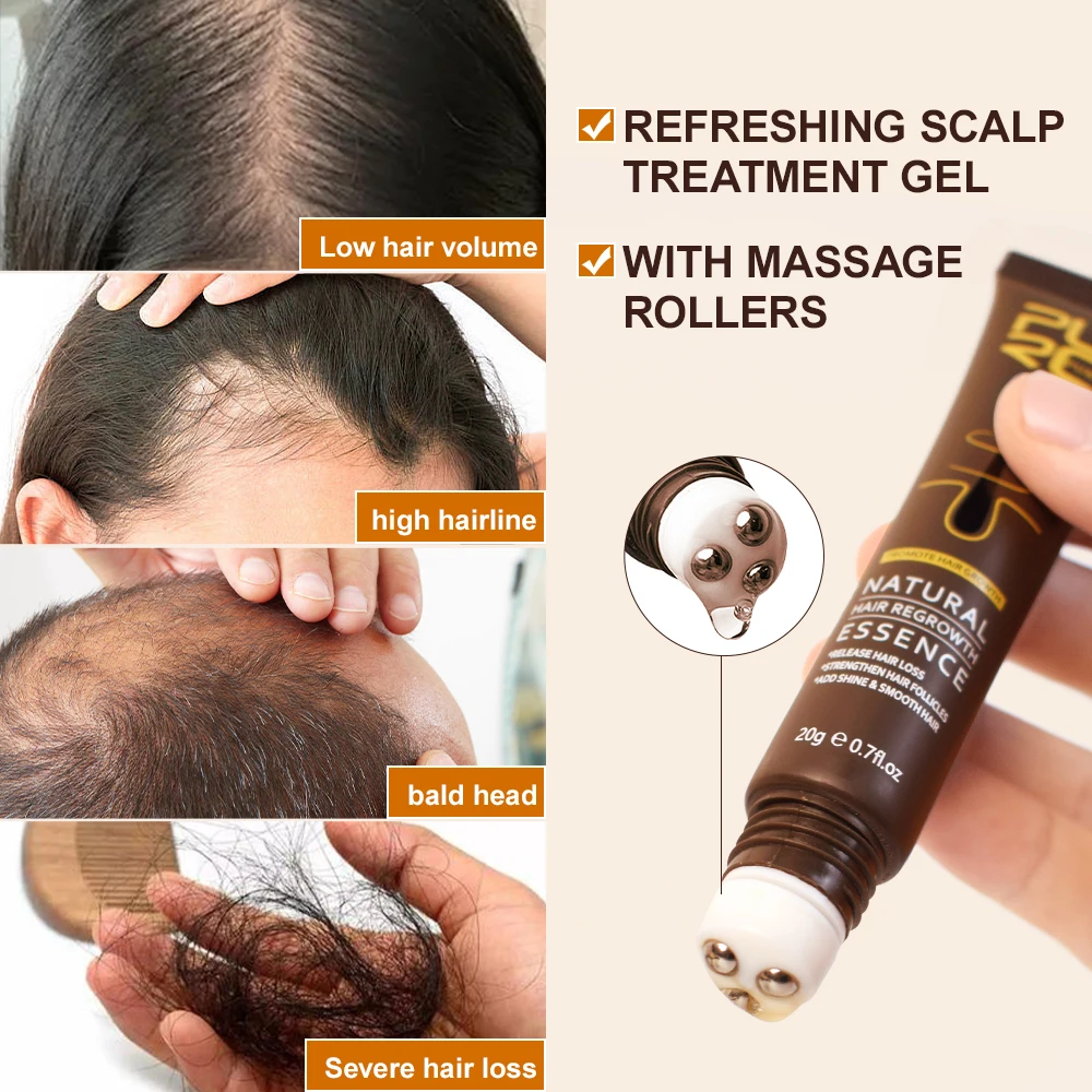 Anti Hair Loss Hair Growth Products Men Women Bald Remedy Roller Scalp Massage Treatment Ginger Fast Grow Hair Serum