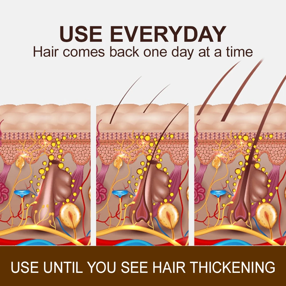 Anti Hair Loss Hair Growth Products Men Women Bald Remedy Roller Scalp Massage Treatment Ginger Fast Grow Hair Serum