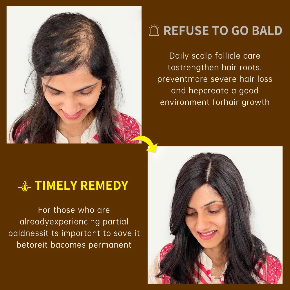 Anti Hair Loss Hair Growth Products Men Women Bald Remedy Roller Scalp Massage Treatment Ginger Fast Grow Hair Serum