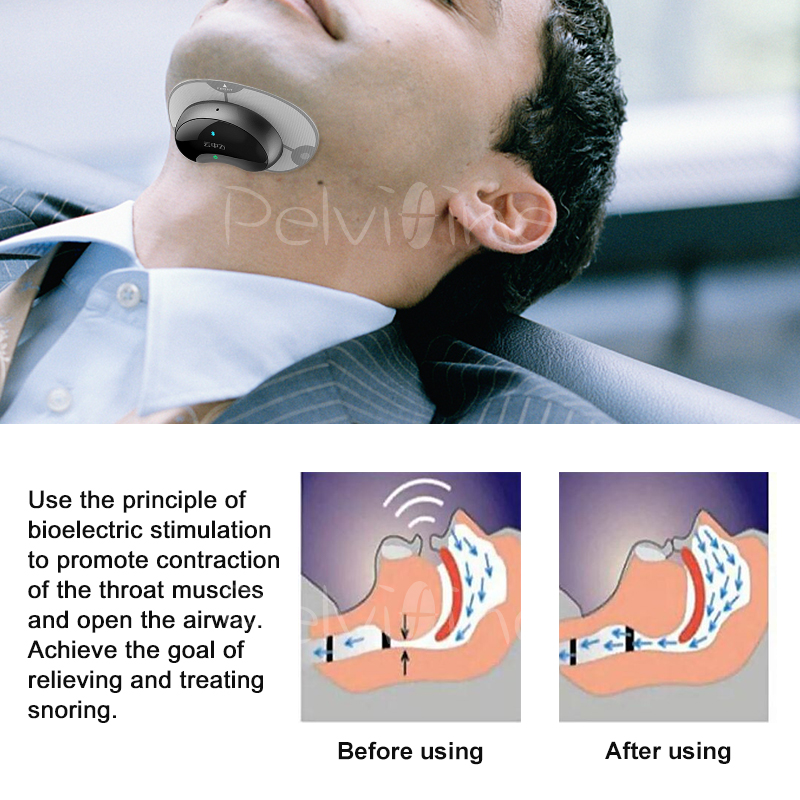 Anti-snoring Device Stopper Anti-snoring Device Stopper