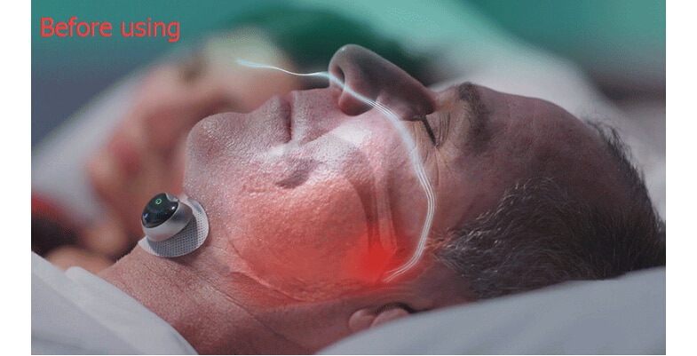 Anti-snoring Device Stopper Anti-snoring Device Stopper