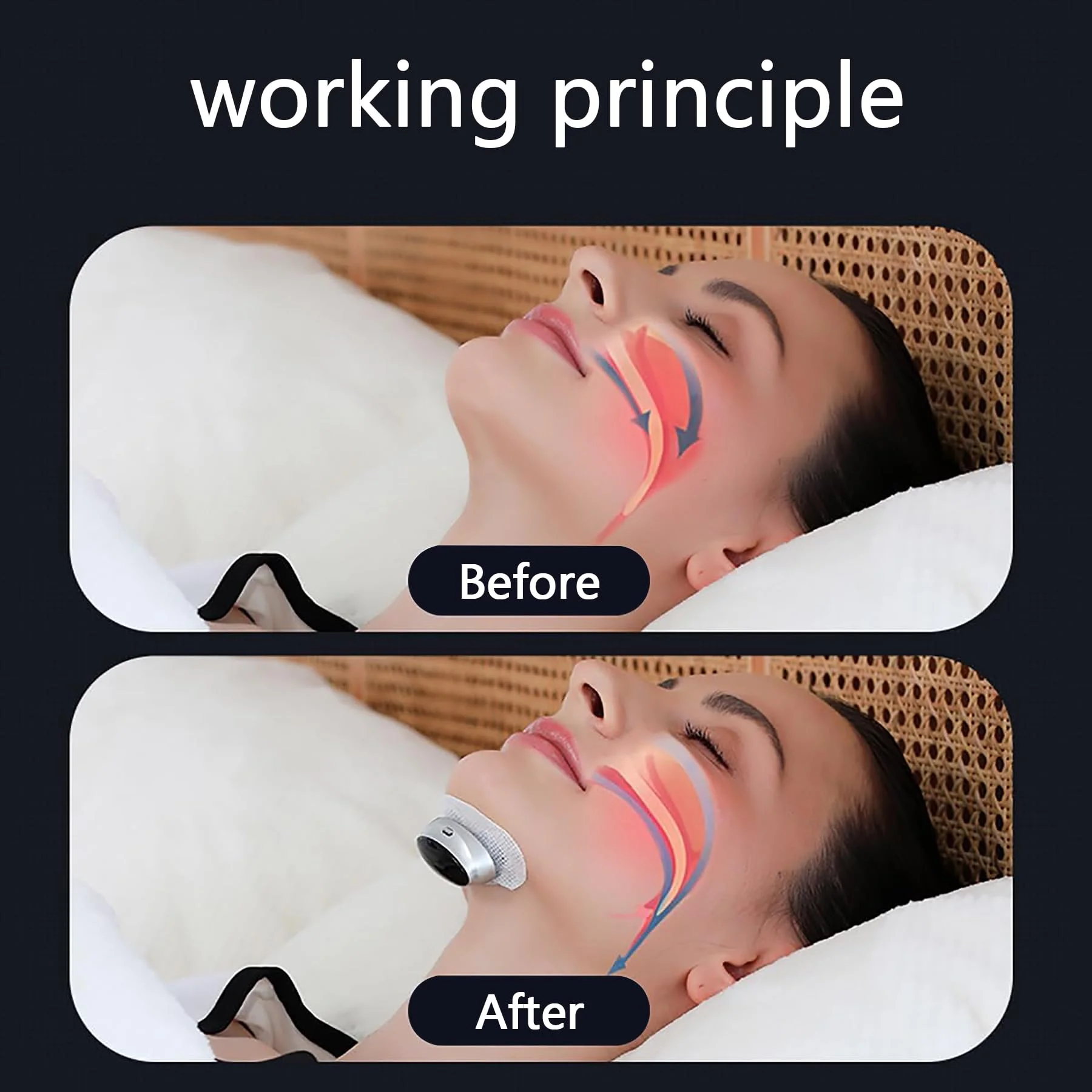 Anti Snoring Devices Electric, ElectricAnti Snoring Bean, Snoring SleepDevice, Easy to use Portable ThreeSpeed Anti Snoring Devices Electric, ElectricAnti Snoring Bean, Snoring SleepDevice, Easy to use Portable ThreeSpeed