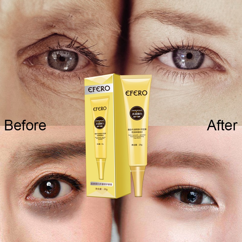 Anti Wrinkle Eye Cream Moisturizer Anti Wrinkle Eye Cream Moisturizer