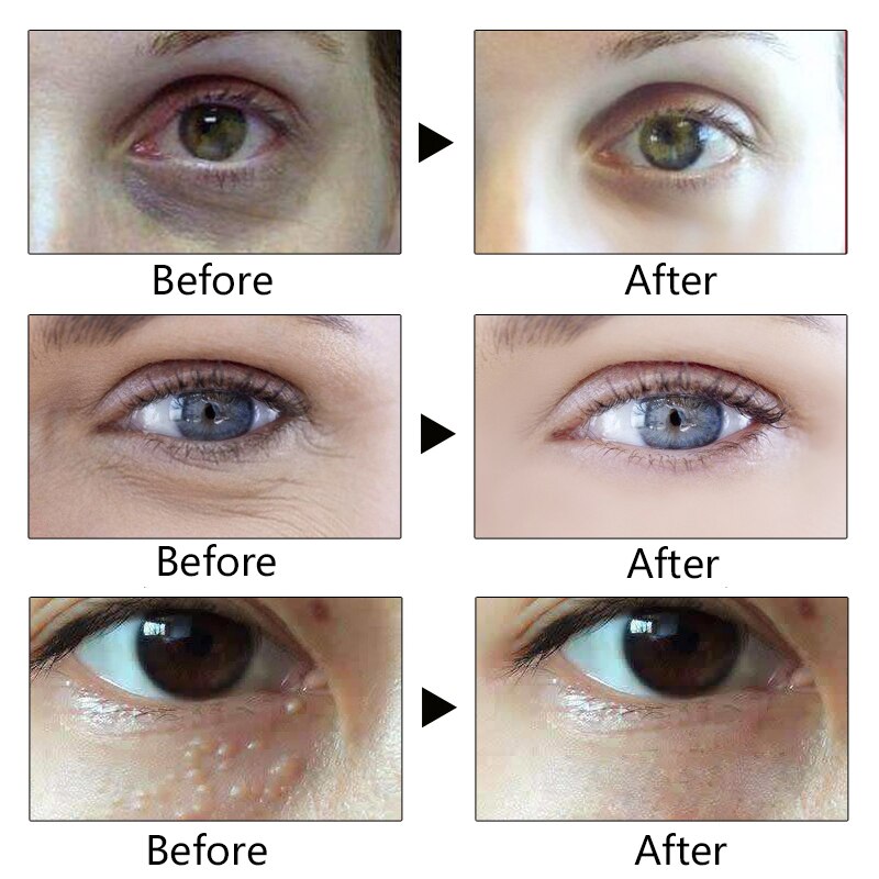 Anti Wrinkle Eye Cream Moisturizer Anti Wrinkle Eye Cream Moisturizer