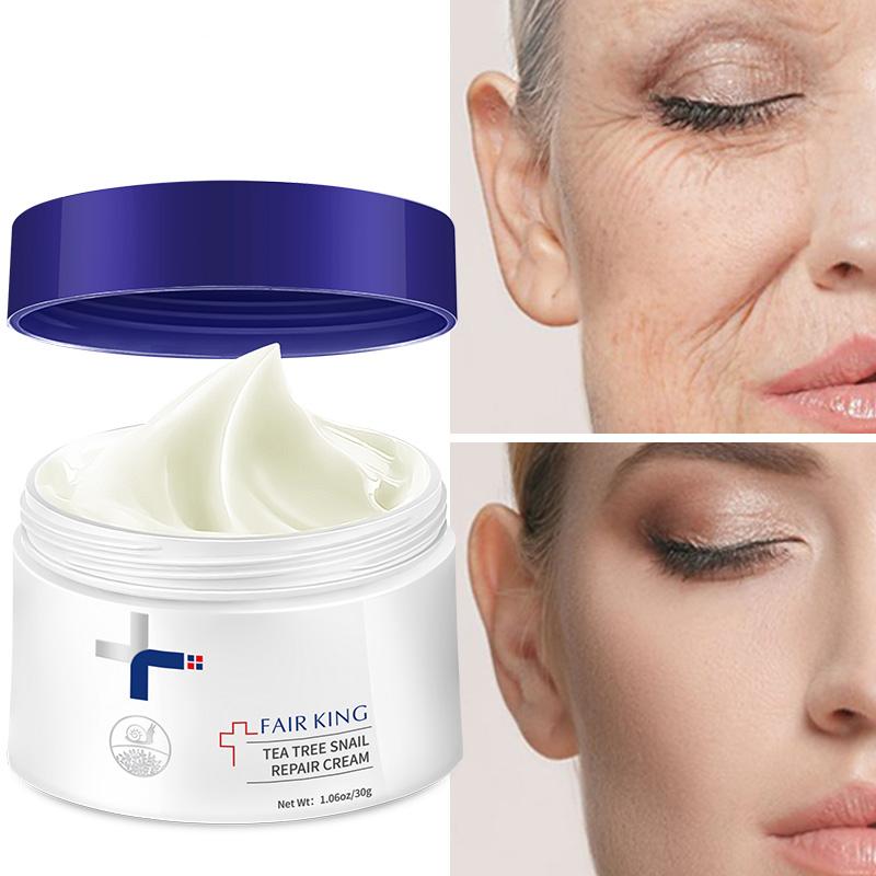 Anti Wrinkle Moisturizing Face Fine Lines Whitening Cream Snail Sodium Hyaluronate Nourishing Skin Treatment Wrinkle Anti Wrinkle Moisturizing Face Fine Lines Whitening Cream Snail Sodium Hyaluronate Nourishing Skin Treatment Wrinkle