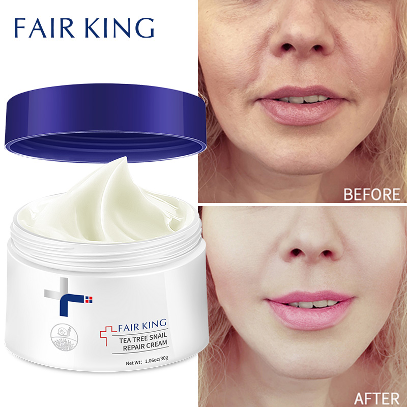 Anti Wrinkle Moisturizing Face Fine Lines Whitening Cream Snail Sodium Hyaluronate Nourishing Skin Treatment Wrinkle Anti Wrinkle Moisturizing Face Fine Lines Whitening Cream Snail Sodium Hyaluronate Nourishing Skin Treatment Wrinkle