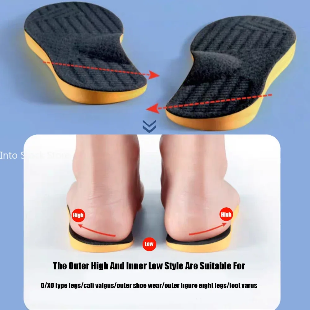 Arch Support Flat Foot Orthopedic Insoles for Shoes Women Men Children X/O Type Legs Valgus Feet Correction Sports Shoe