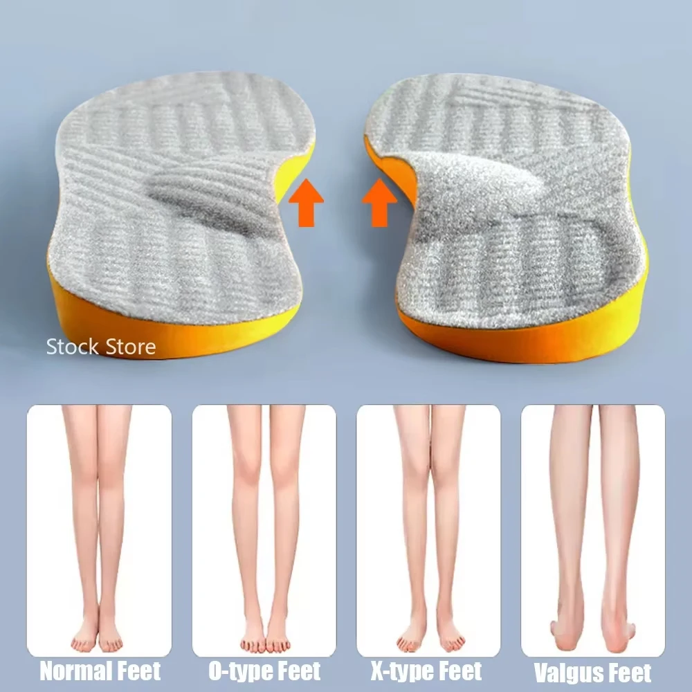 Arch Support Flat Foot Orthopedic Insoles for Shoes Women Men Children X/O Type Legs Valgus Feet Correction Sports Shoe