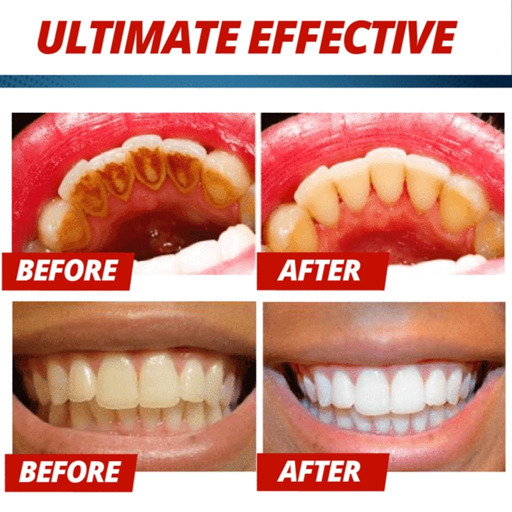 Baking Soda Toothpaste Dental Care Baking Soda Toothpaste Dental Care