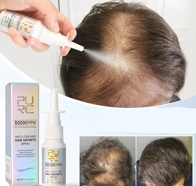 Biotin Hair Growth Products for Men Women Hair Loss Treatment Fast Grow Hair Spray Regrowth Thicken Oil Hair Care