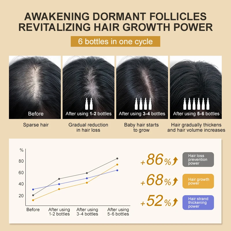 Biotin Hair Growth Products for Men Women Hair Loss Treatment Fast Grow Hair Spray Regrowth Thicken Oil Hair Care