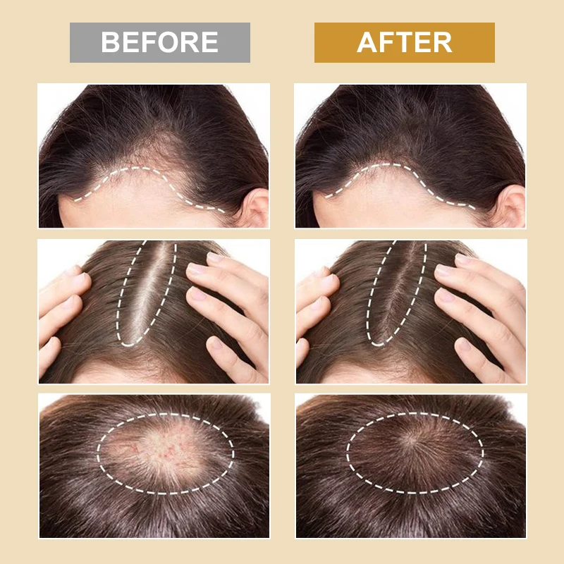 Biotin Hair Growth Products for Men Women Hair Loss Treatment Fast Grow Hair Spray Regrowth Thicken Oil Hair Care