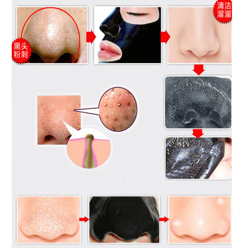 Blackhead Face Mask Facial Care (Set of 5)