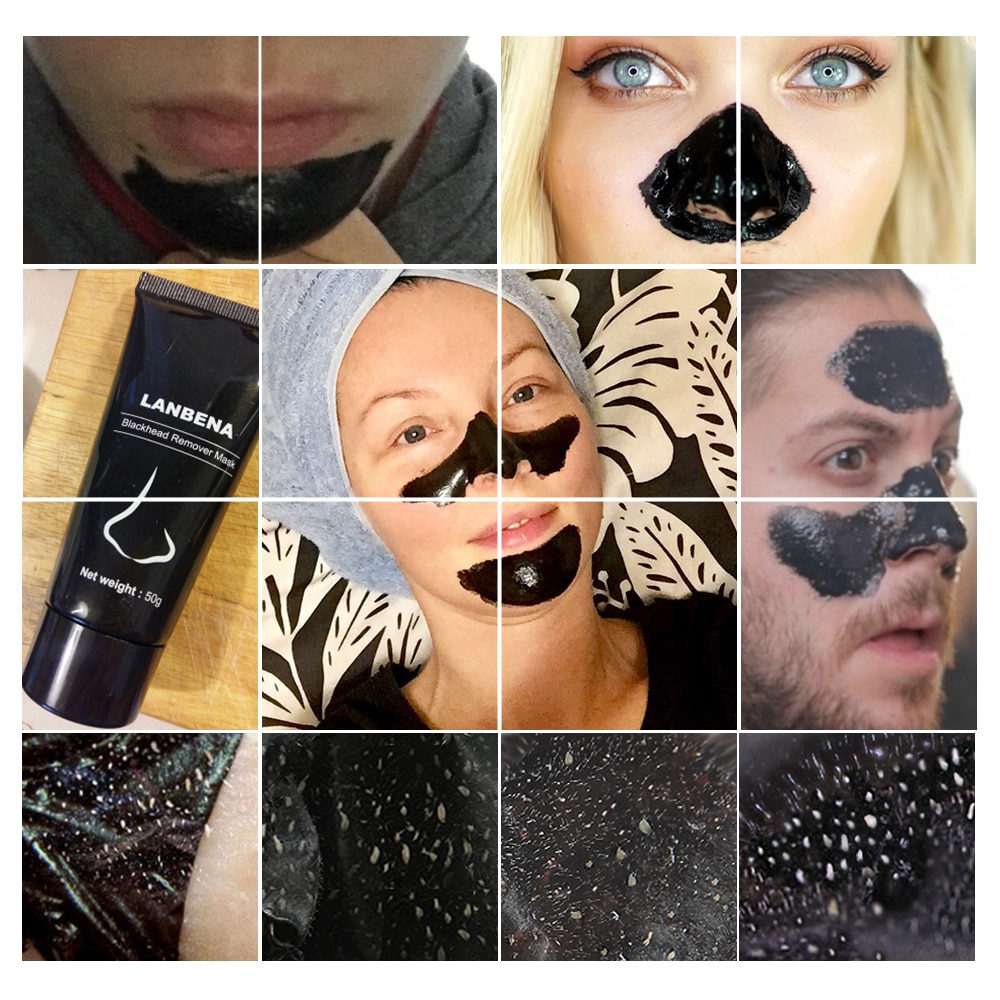 Blackhead Removal Mask Treatment Blackhead Removal Mask Treatment