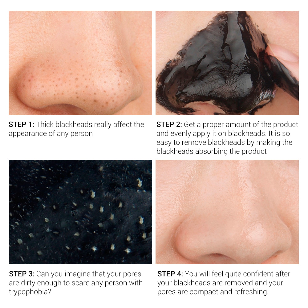 Blackhead Removal Mask Treatment Blackhead Removal Mask Treatment