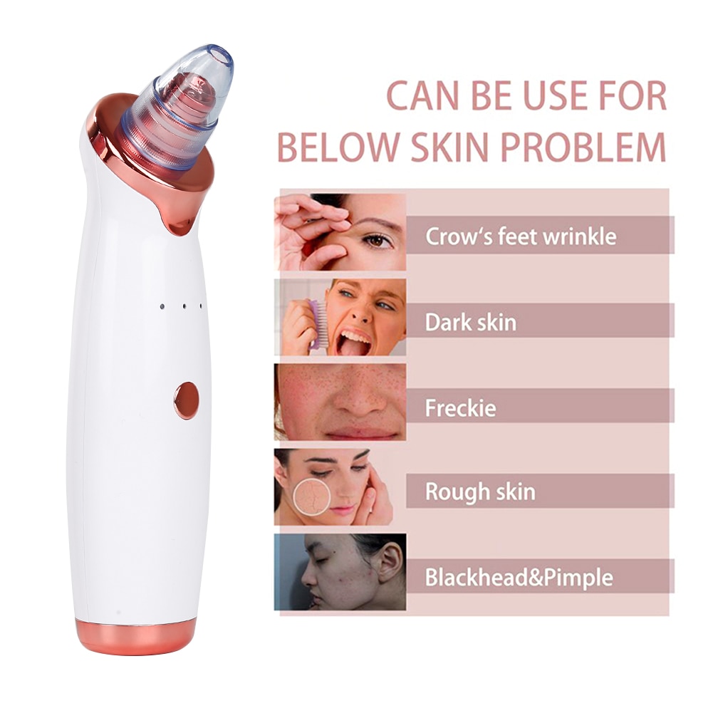 Blackhead Remover Vacuum Pore Cleanser Blackhead Remover Vacuum Pore Cleanser