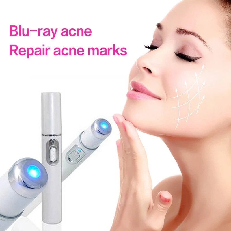 Blue Light Acne Wrinkle Removal Laser Pen Skin Spots Removal Anti Varicose Spider Vein Treatment Medical Blue Light Eye Blue Light Acne Wrinkle Removal Laser Pen Skin Spots Removal Anti Varicose Spider Vein Treatment Medical Blue Light Eye
