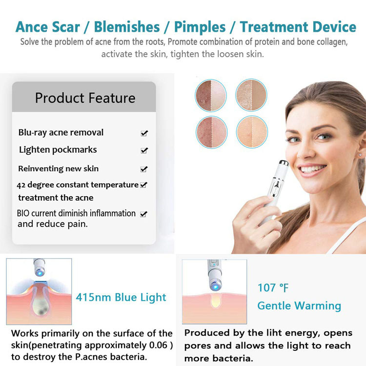 Blue Light Acne Wrinkle Removal Laser Pen Skin Spots Removal Anti Varicose Spider Vein Treatment Medical Blue Light Eye Blue Light Acne Wrinkle Removal Laser Pen Skin Spots Removal Anti Varicose Spider Vein Treatment Medical Blue Light Eye