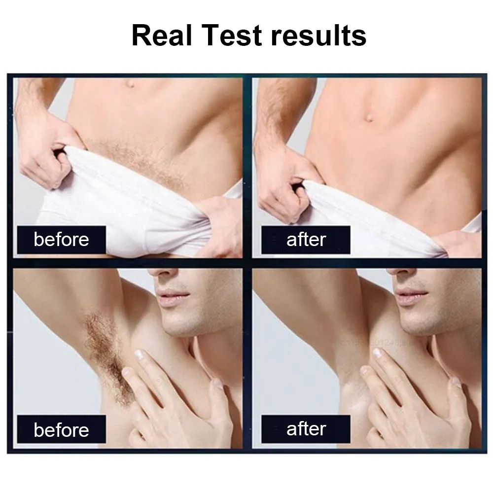 Body Trimmer For Men Painless Epilator Rechargeable Shaver For Sensitive Areas Bikini IPX7 Electirc Epilator Body Hair Body Trimmer For Men Painless Epilator Rechargeable Shaver For Sensitive Areas Bikini IPX7 Electirc Epilator Body Hair